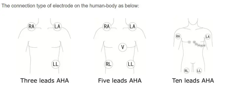 フィリップスディジットラック用の5リードECGリード線と24時間ホルター3100A、5リード、スナップ